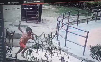 ग्रेटर नोएडा की एक सोसायटी के पार्क में 8 साल के मासूम को स्ट्रीट डॉग ने काटा