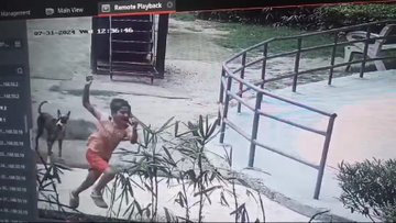 ग्रेटर नोएडा की एक सोसायटी के पार्क में 8 साल के मासूम को स्ट्रीट डॉग ने काटा