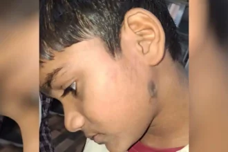 हरदोई में सहायक अध्यापक ने छात्र की पिटाई की, नाक से खून बहने व चेहरे पर उंगलियों के निशान के बाद परिजनों ने थाने पर दी तहरीर