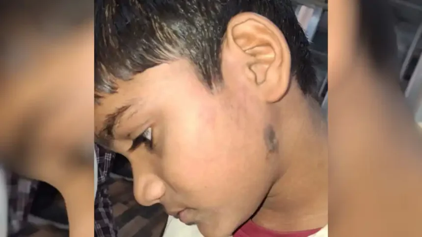 हरदोई में सहायक अध्यापक ने छात्र की पिटाई की, नाक से खून बहने व चेहरे पर उंगलियों के निशान के बाद परिजनों ने थाने पर दी तहरीर