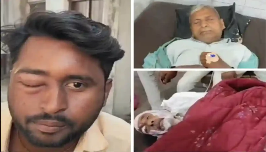 जालौन में अंतिम संस्कार यात्रा पर मधुमक्खियों का हमला, 50 से ज्यादा लोग घायल