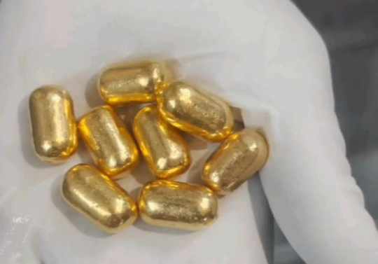 Moradabad News: सोने की तस्करी में बड़ा खुलासा, पेट में ले जा रहे थे कैप्सूल, अब तक 27 कैप्सूल बरामद