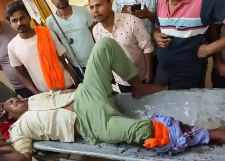 Hardoi News: दो बाइको की टक्कर से एक सवार का पैर टूटा, दूसरा बाइक सवार फरार, पुलिस तलाश में 