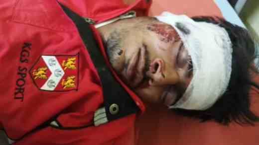 Hardoi News: नशे की हालत मे बाईक से गिरा युवक, घायल रेफर, कोथावा अतरौली मार्ग पर मीनाबाजार समीप का मामला