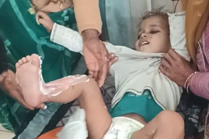 Hardoi News: खौलते हुए कढ़ाई का पानी मां बेटे पर गिरा झुलसे, दोनों को सामुदायिक स्वास्थ्य केंद्र कछौना में भर्ती