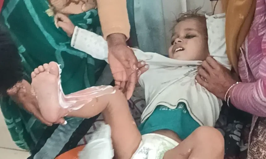 Hardoi News: खौलते हुए कढ़ाई का पानी मां बेटे पर गिरा झुलसे, दोनों को सामुदायिक स्वास्थ्य केंद्र कछौना में भर्ती