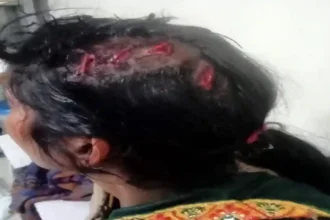 Hardoi News: नौकरी दिलाने का झांसा देकर महिला को बेनीगंज बुला कर की मारपीट, घायल