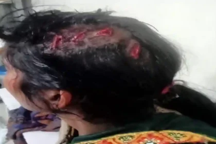 Hardoi News: नौकरी दिलाने का झांसा देकर महिला को बेनीगंज बुला कर की मारपीट, घायल