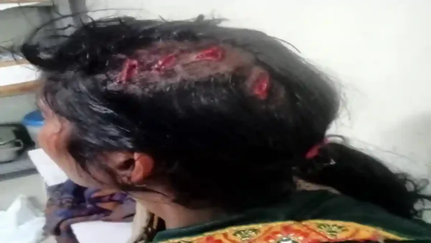 Hardoi News: नौकरी दिलाने का झांसा देकर महिला को बेनीगंज बुला कर की मारपीट, घायल